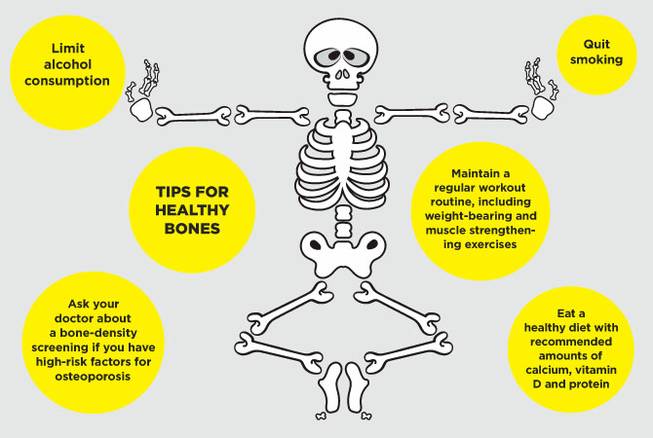 Take Care Of Your Bones Now To Prevent Osteoporosis Later In