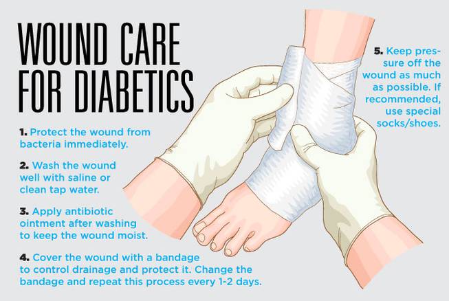 HCA diabetic wound care and foot ulcer native 