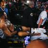 Conor McGregor is taken out on a stretcher after severely injuring his ankle during a UFC 264 lightweight bout against Dustin Poirier at T-Mobile Arena Saturday, July 10, 2021. Poirier won by TKO.